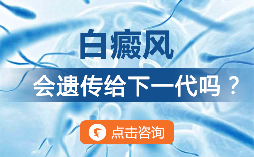白癜風(fēng)會遺傳嗎