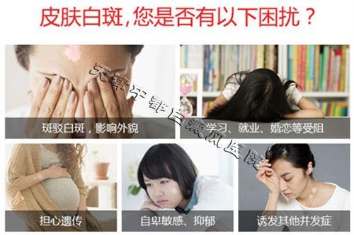 白癜風危害