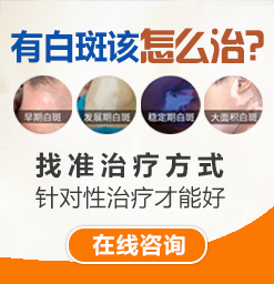 天津白癜風治療要多少錢？